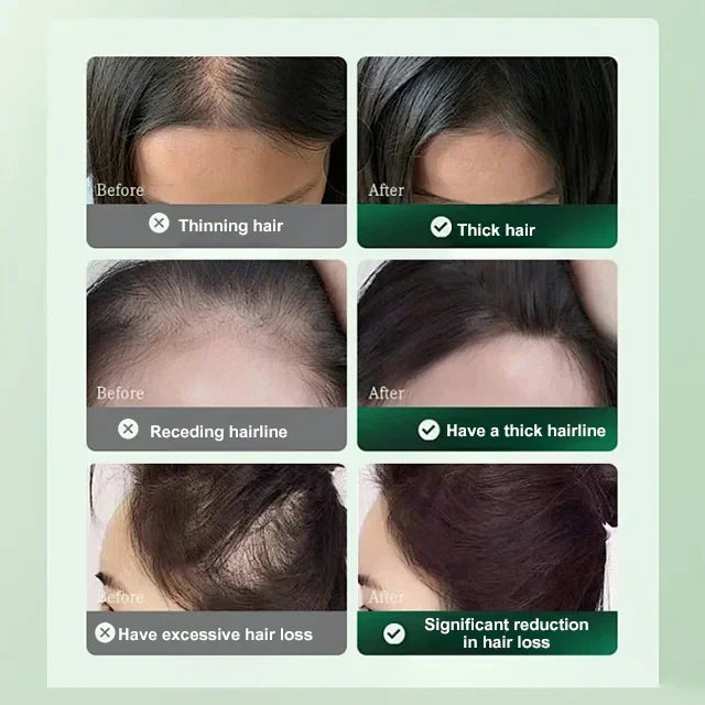 SOLUÇÃO ANTI-QUEDA DE CABELO E CRESCIMENTO DE CABELO 